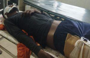 Bokaro News : बहन की शादी का कार्ड बांटने जा रहा युवक सड़क दुर्घटना में घायल